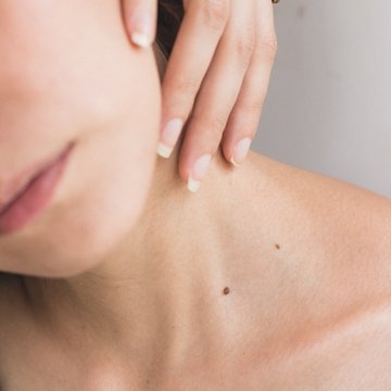 Urlaub in Söll mit Kindern oder als Pärchen Nahaufnahme von Frau mit Hand am Hals und sichtbaren Muttermalen